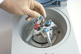 Blog for Dental Care Costa Rica