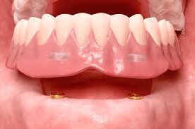 Blog for Dental Care Costa Rica