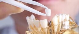 Dental Care Costa Rica